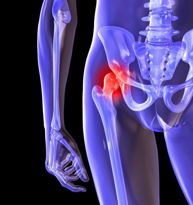 cum se vindecă inflamația articulației genunchiului dureri de poliartrită în articulația șoldului