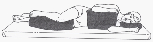 Bolesti chrbta v dolnej časti - antalgická poloha
